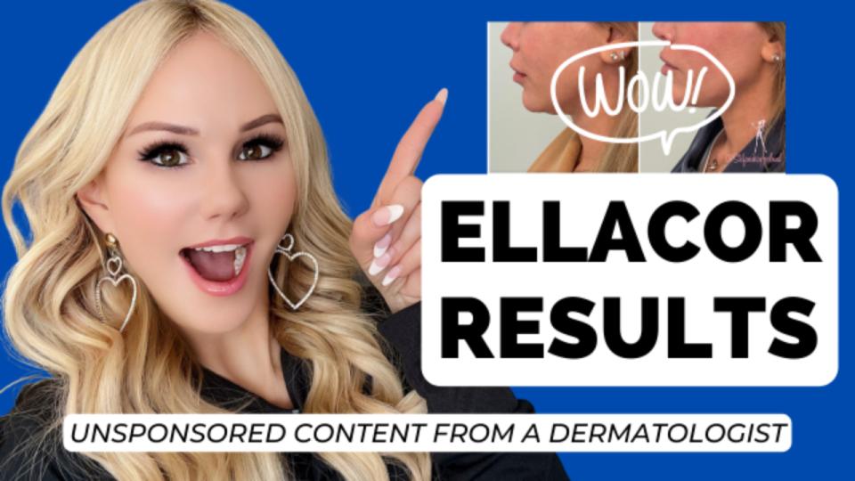 Early Ellacor results!
